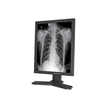 睿显 医用显示器 MD33G（灰阶）