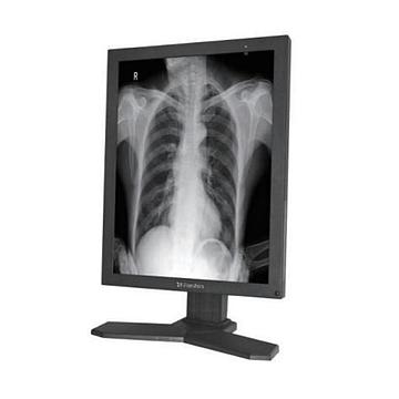 睿显 医用显示器 MD26GA
