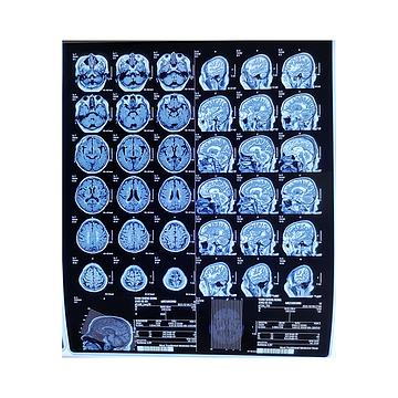易联云影 热敏胶片 8in × 10in（100张/盒 5盒/箱）