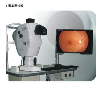 眼底照相机TK2000R 眼底照相机排行榜:10款热门产品选型参考(图9)
