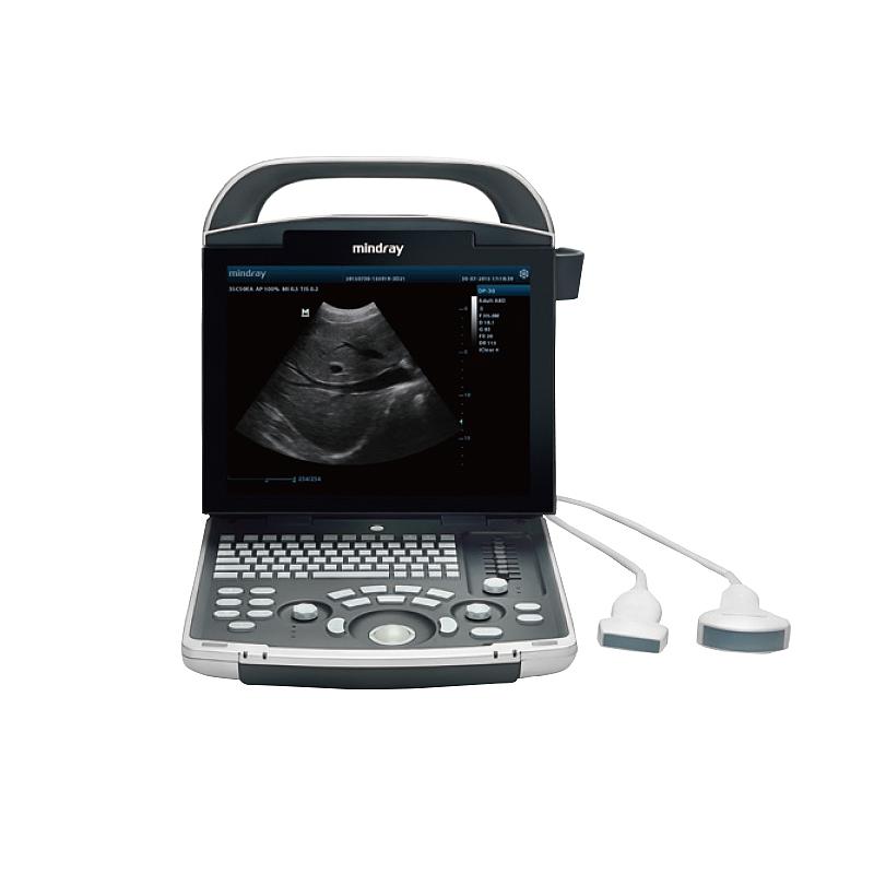 迈瑞Mindray 全数字便携式超声诊断系统 DP-30（主机+腔内65EC10EA）