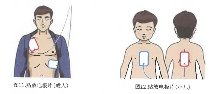 AED训练机选购指南(图2) AED训练机选购指南(图2)